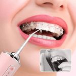 Портативний іригатор для ротової порожнини — изображение 6